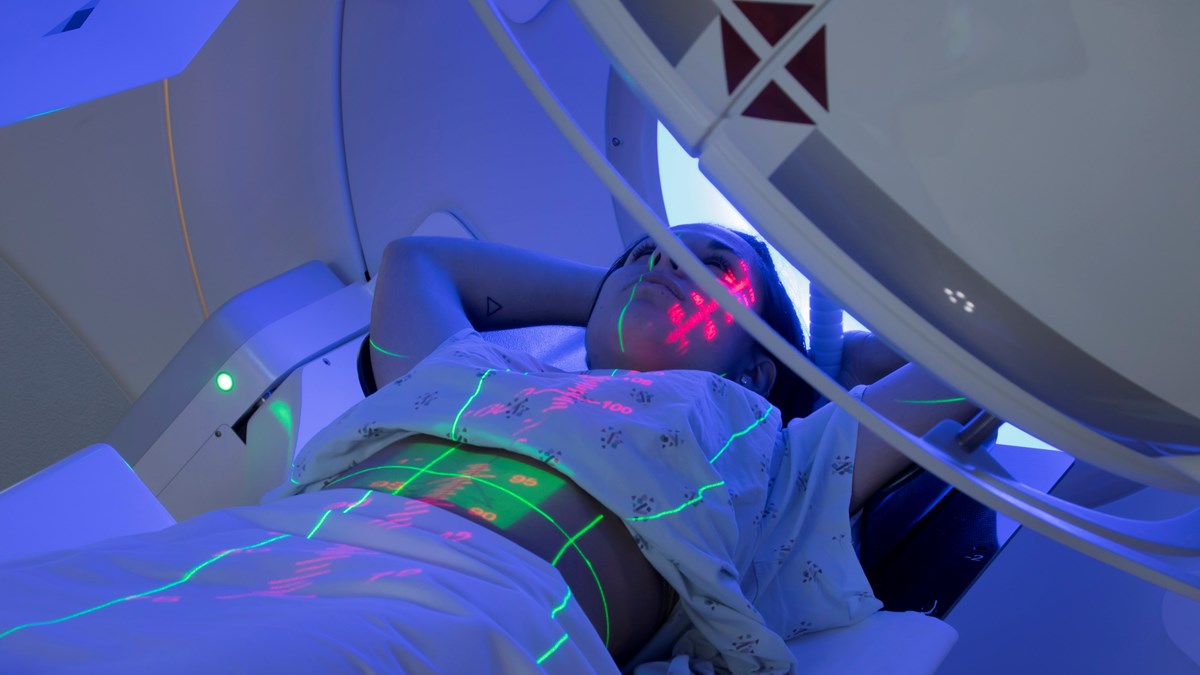 Halvbild på en person som ligger i en strålningsmaskin och får strålningsbehandling. Gröna och röda ljusmarkeringar syns på personens kropp.