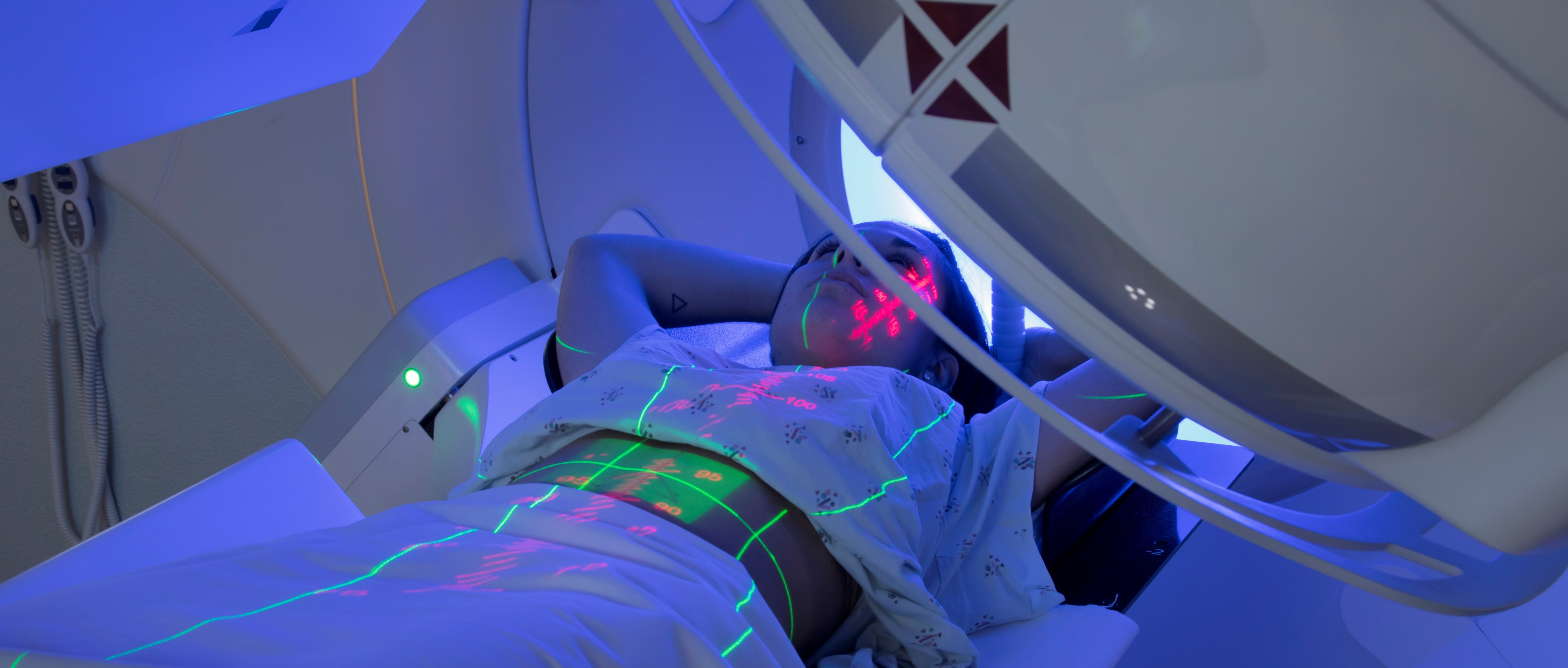 Halvbild på en person som ligger i en strålningsmaskin och får strålningsbehandling. Gröna och röda ljusmarkeringar syns på personens kropp.